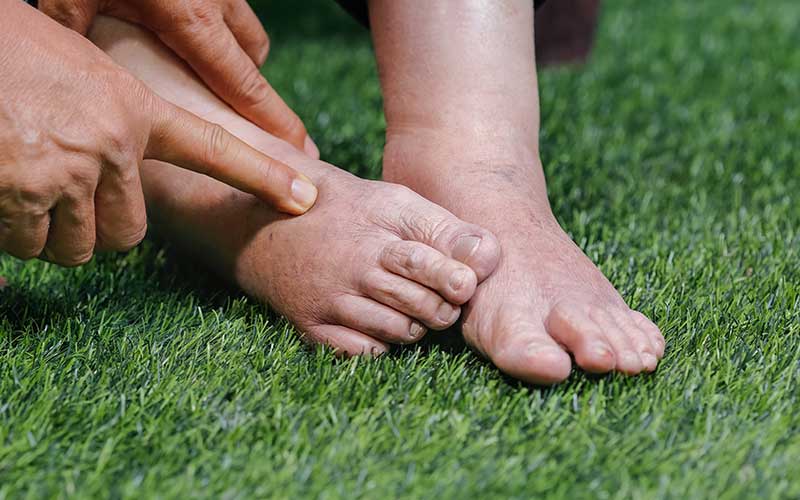 10 Kidney Failure Symptoms Most People Will Miss!